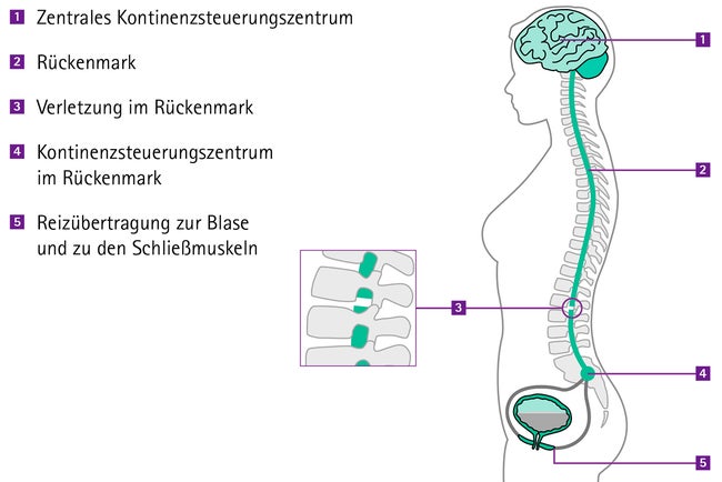 Illu01a-Wirbelsäule_210506_RGB Kopie