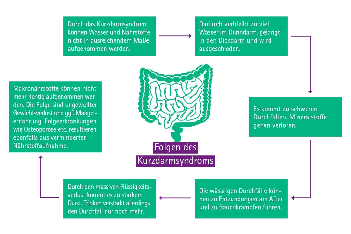 Infografik: Folgen des Kurzdarmsyndroms