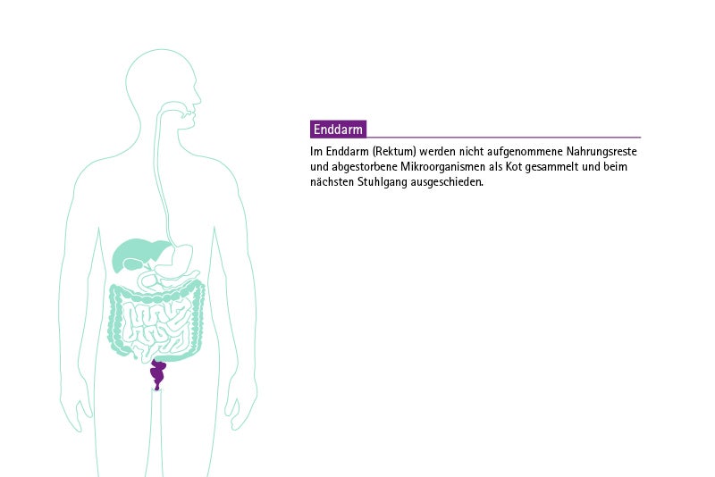 Infografik KDS Verdauungstrakt: Enddarm