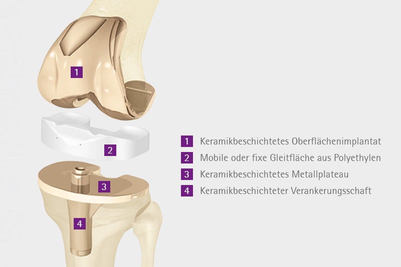 Kompletter Oberflächenersatz