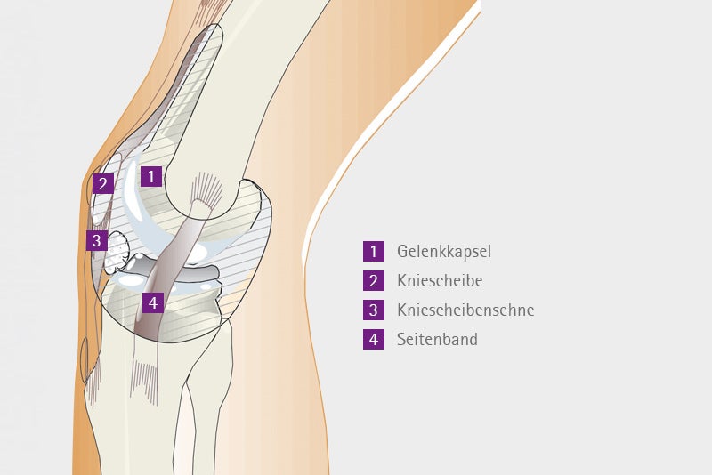 Ausdehung der Gelenkkapsel